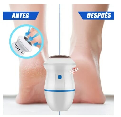 Removedor eléctrico para retirar los callos de los pies